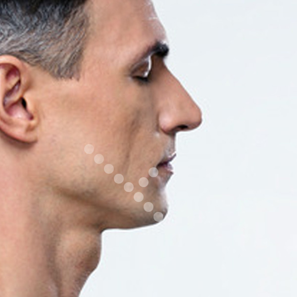 Maxillofacial Aesthetics